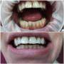 Dentální hygiena Pavlína Peterová, DiS