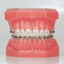 Pro-smile sro