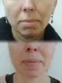 LLC Estetická klinika Ostrava